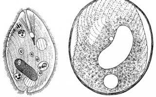 Цикл развития кишечного паразита Balantidium Coli
