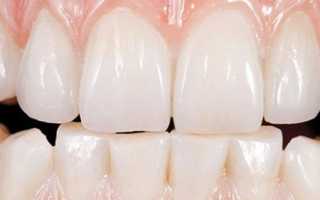 Эстетическая реставрация зубов коронками Prettau