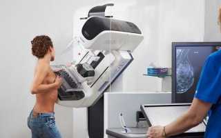 УЗИ молочной железы или маммография: что лучше и информативнее, плюсы и минусы процедур