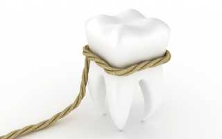 Что необходимо знать об удалении подвижного зуба?