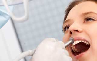 Механизм распространения инфекции по зубу и нюансы лечения в зависимости от степени запущенности процесса
