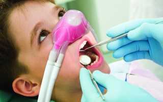 Что дает пациенту лечение зубов под закисью азота и насколько это безопасно