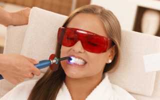Лазерное отбеливание зубов: отзывы, цены и описание процедуры