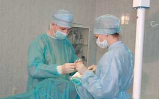 Суть операции альвеолотомии и ожидаемый результат
