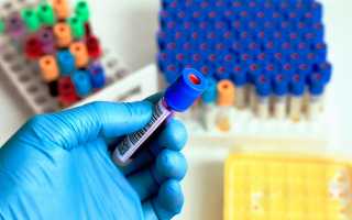 Эритропоэтин — анализ крови что показывает, нормы значений