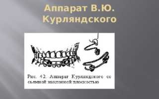 Ортодонтические аппараты В.Ю. Курляндского и их особенности