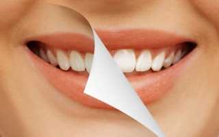 Покоряй улыбкой после отбеливания зубов системой Bleach ́n Smile