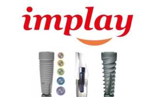 Импланты от компании Implay ― залог качества по доступной цене