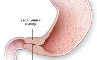 Утолщение стенки желудка на УЗИ: каковы причины, особенности диагностики