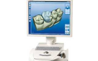 Новейшие технологии в стоматологической ортопедии – эстетика и функциональность коронок Cerec